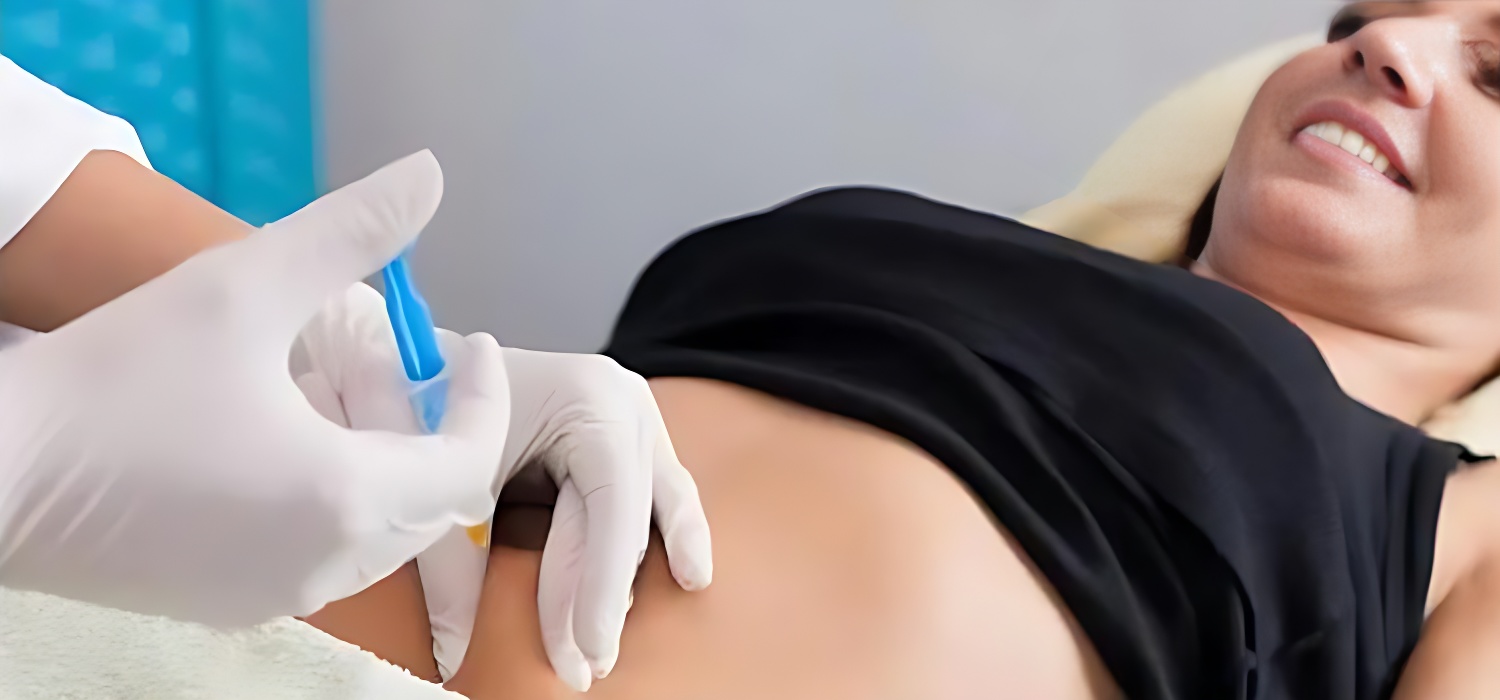 Lipolitik Mezoterapi